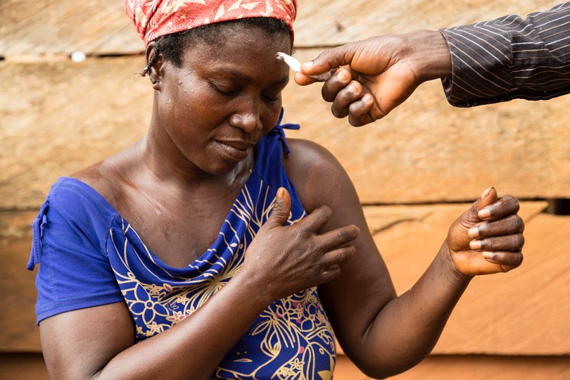 © Elssie Ansareo/Anesvad “Close your eyes and let me know if you feel this”. A senior field technician for leprosy in Ghana starts diagnosis through the skin sensation test.