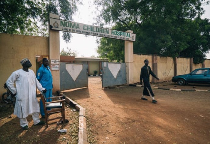 The Sokoto Noma Hospital, in north-west Nigeria, is the only one in the country dedicated to this neglected and devastating infection. Photo: Claire Jeantet - Fabrice Caterini/Inediz