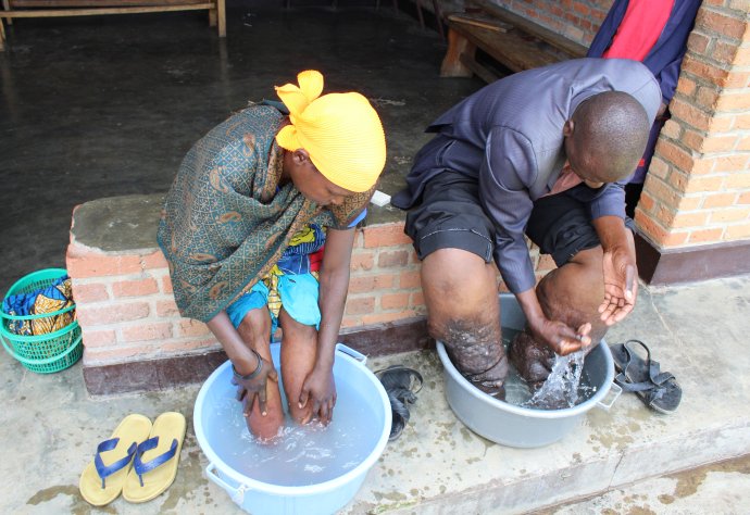 Credit: Professor Gail Davey. Caption: Rwandan podoconiosis patients learning self-care for their legs