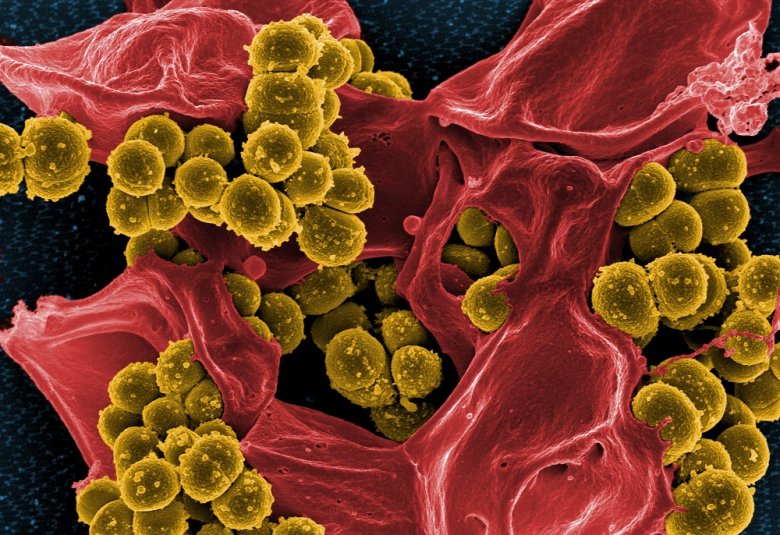 Micrograph of Methicillin-Resistant Staphylococcus aureus (MRSA) © NIAID Micrograph of Methicillin-Resistant Staphylococcus aureus (MRSA) © NIAID