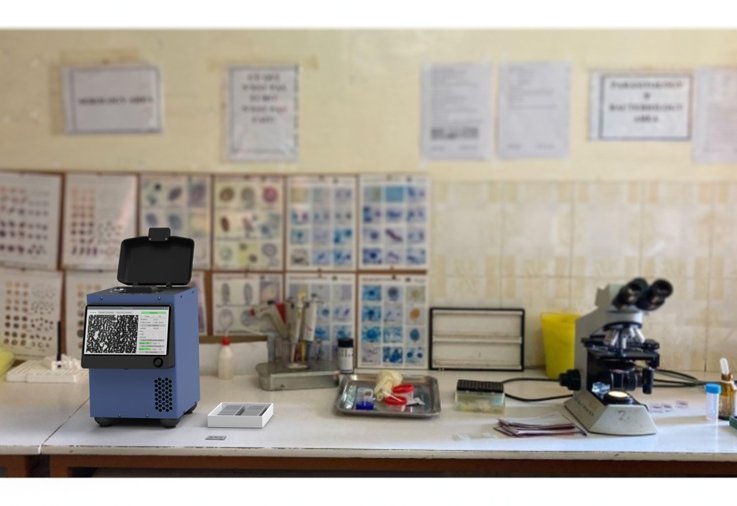 Remoscope (foreground, left of center) is an AI-powered, label-free imaging cytometer that scans fresh whole blood for malaria parasites. Credit:  Dr Paul Lebel