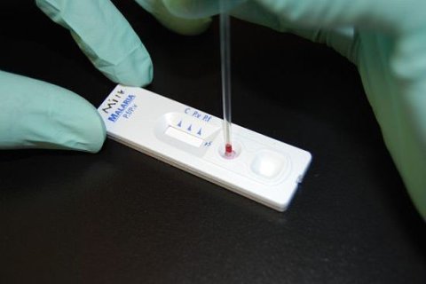 A rapid diagnostics test. © CDC Global https://creativecommons.org/licenses/by/2.0/