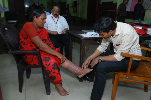 Filariasis - a lifetime burden that threatens livelihood