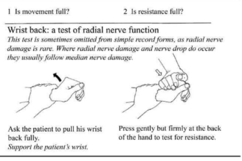 Wrist back test - line drawing by Jean Watson (Essential Action to Minimize Disability in Leprosy Patients, Jean M Watson, second edition,1994)