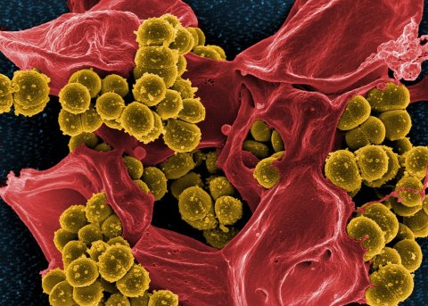 Micrograph of Methicillin-Resistant Staphylococcus aureus (MRSA) © NIAID