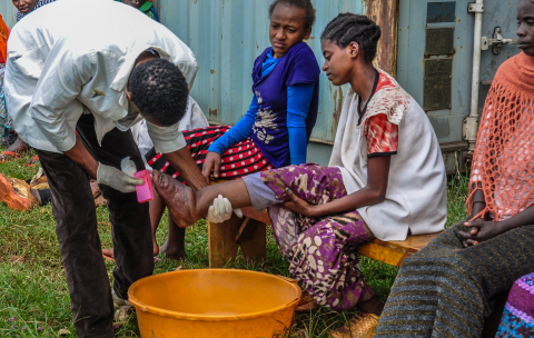 The simple treatment of podoconiosis. Tigist is successfully treated and goes back to school now. Photo: Jelle Visser