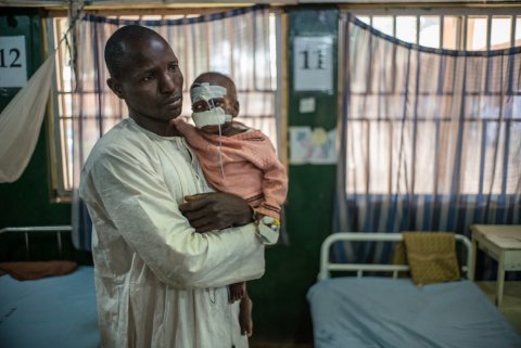 Mohammed, 2, at the Sokoto Noma Hospital with his father, Grema. He was severely malnourished and not able to eat due to wounds caused by noma. Credit: Claire Jeantet - Fabrice Caterini/Inediz