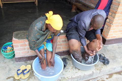 Credit: Professor Gail Davey. Caption: Rwandan podoconiosis patients learning self-care for their legs