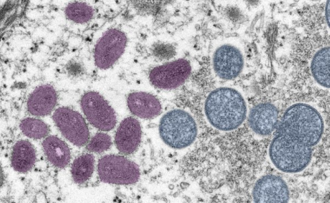 mpox Credit CDC Cynthia S. Goldsmith, Russell Regnery, Hannah Bullock Monkeypox Credit CDC Cynthia S. Goldsmith, Russell Regnery, Hannah Bullock