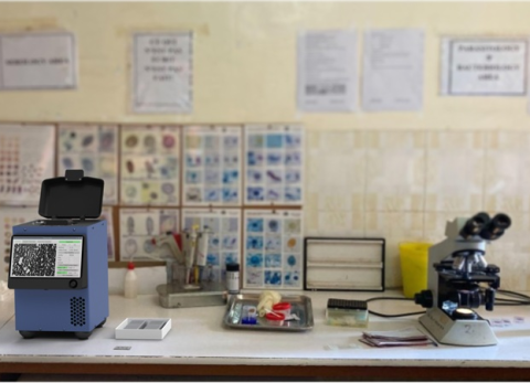 Remoscope (foreground, left of center) is an AI-powered, label-free imaging cytometer that scans fresh whole blood for malaria parasites. Credit: Dr Paul Lebel